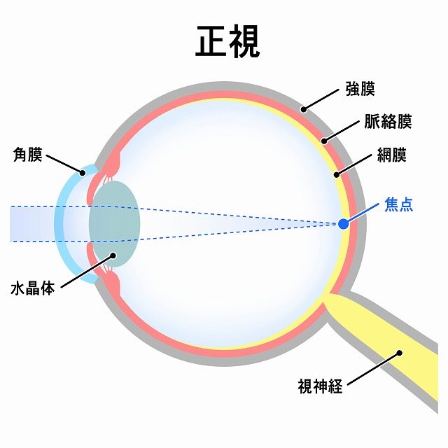 正視